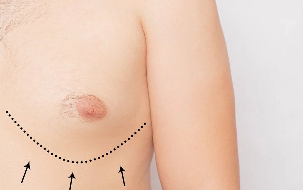 Highlighting His Headlights